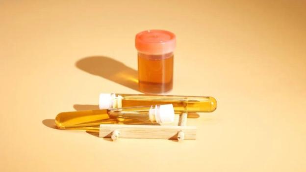 4种睡眠异常提示肾出问题 警惕夜间身体信号