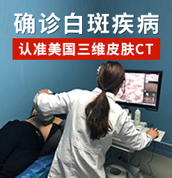 郑州西京白癜风专科医院如何治疗眼部的白癜风