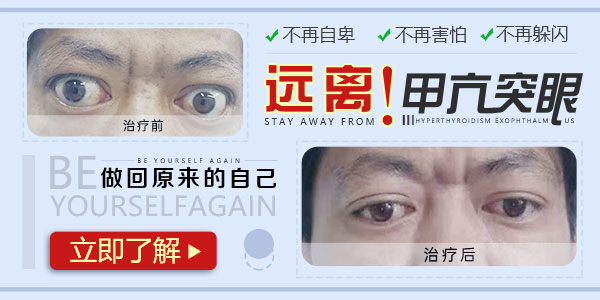 安顺治疗甲亢注意什么