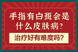 昆明治疗晕痣白癜风好的医院-怎么保持良好的心态