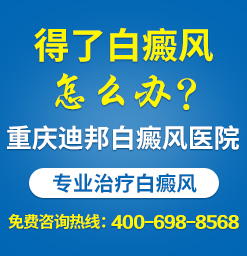 重庆白癜风非常好的专科医院 老年白癜风的治疗办法