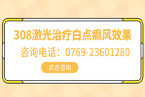 308激光治疗白点癫风效果怎么样-白点癫风的早期图片治疗方式