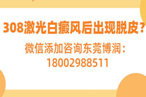 惠州较好的白癜风医院 308激光白癜风照射后出现脱皮是怎么回事