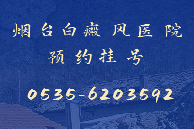 烟台白癜风治疗医院如何?烟台的白癜风医院治疗吗
