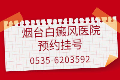 烟台白癜风的医院哪个治疗成效好 烟台白癜风治疗医院是重点医院吗