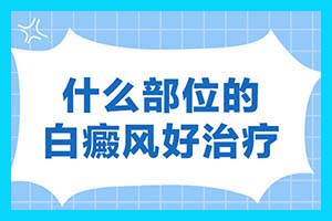 昆明白癜风医院 如何治疗早期白斑