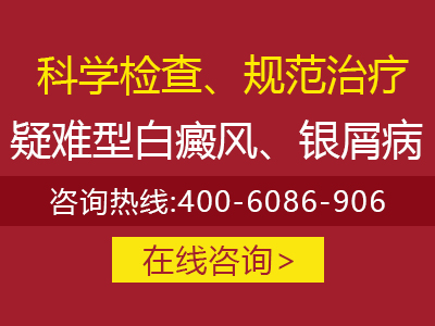 银屑病未来能治疗吗-银屑病有未来吗