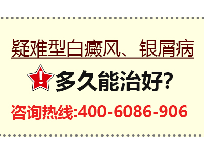 牛皮癣可以放血治疗吗-放血疗法能治银屑病吗