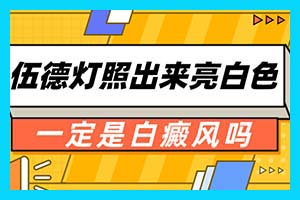 昆明哪里白癜风治得好 得了白癜风要怎么办