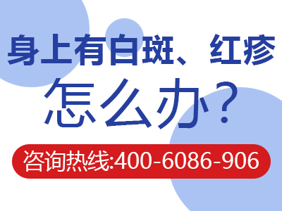 银屑病把血放出来就好了-银屑病放血越来越严重