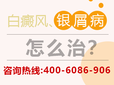 榆树银屑病医院的价格-榆树治疗银屑病多少钱