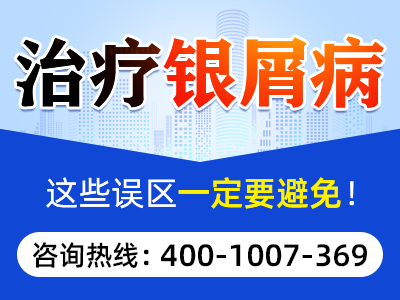 点滴型银屑病症状表现_点滴型银屑病征兆