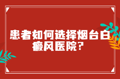 烟台半岛医院专业吗-患者如何选择烟台白癜风医院