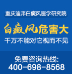 重庆看白癜风专科医院 如何治疗白癜风更加科学