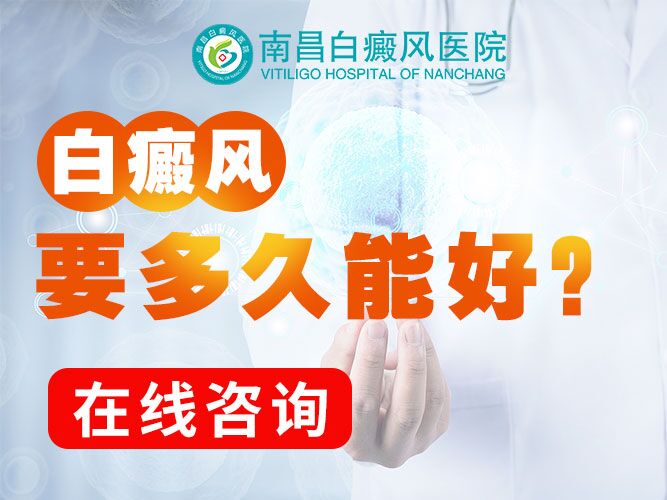 南昌白癜风医院专家预约-男性预防白癜风要做到的两大点?