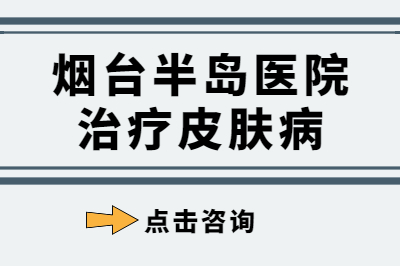 烟台皮肤病医院治疗好吗-预防银屑病的方法是什么