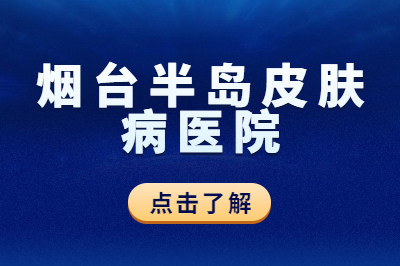 烟台银屑病治疗的医院有哪家的效果是好的-怎么治银屑病有效