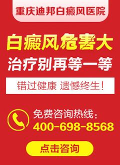 重庆哪里有白癜风专科医院 白癜风对成年患者会有多大?