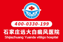 沧州治疗白癜风排名前十的医院-如何治疗白癜风呢