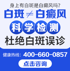 白癜风治疗的误区-广州哪个医院专业治疗白癜风