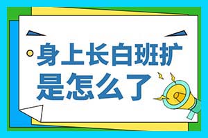 昆明治疗白癜风医院 治疗白癜风的中成药有哪些