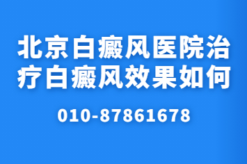 北京卫人治疗白斑有效吗?北京哪家医院看白斑效果比较好?