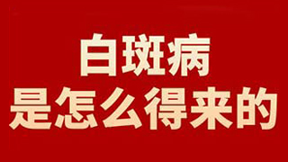 白斑照伍德灯颜色对照表 昆明专业检查白斑的医院是哪家