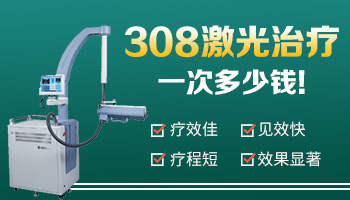 昆明专业白癜风医院 白癜风要不要一直做308激光