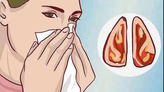 警惕鼻出血的几个危害 北京首大眼耳鼻咽喉医院正规吗