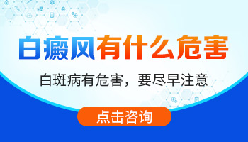 昆明哪家医院可以网上预约医生-昆明肢端白癜风黑色素种植成功概率多少