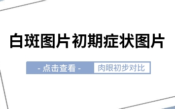 排行榜单 烟台白癜风正规医院 白点癫风发展期有什么症状