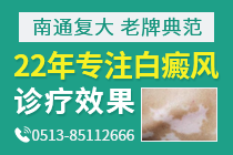 南京白癜风皮肤病医院-白癜风的治疗能拖延吗