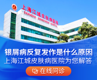 上海专业的牛皮癣医院