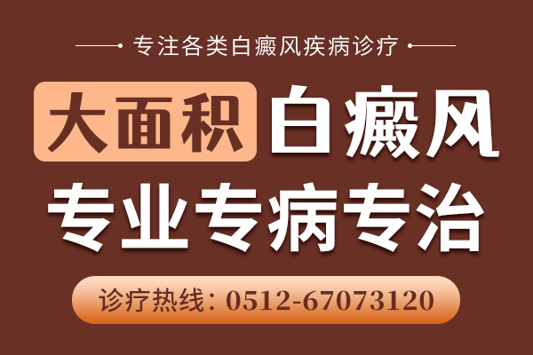 无锡白癜风治疗哪家医院效果好 腿部的白癜风应该怎样做?