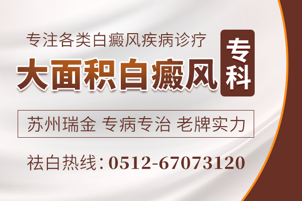 泰州治疗白癜风医院好 夏天白癜风高发期大面积白癜风该怎么护理