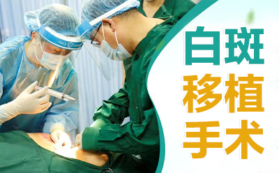 烟台海阳市白癜风医院怎么样,早治疗白癜风有什么益处