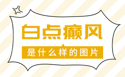 烟台半岛医院收费公开-烟台半岛白斑医院评价口碑