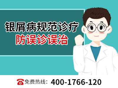 郑州有没有治疗牛皮癣權威的医院_郑州中医看牛皮癣效果如何