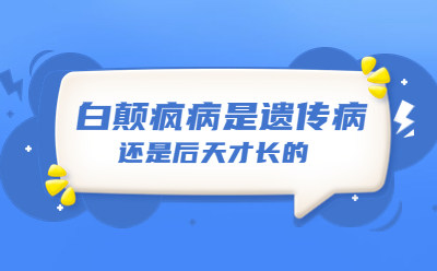 半岛白癜风医院复色帮益帮-面部白点癫风怎么治疗