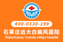 邢台哪个医院治疗脸上白斑-白癜风在扩散期要如何治疗