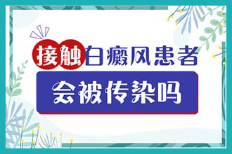 昆明白癜风医院是正规医院吗,白癜风病是哪些原因怎么引起的