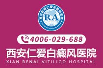 名次前列：西安专业治疗白癜风医院排名榜-儿童白癜风要怎么治疗比较好