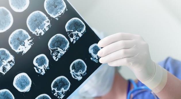 武汉专治癫痫的脑科医院哪家好—癫痫患者的生活细节指南