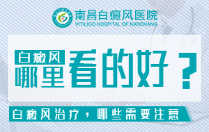 公开：江西白癜风专科医院排名榜，夏季白癜风饮食有哪些小技巧？