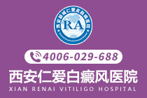 前十排名：西安治疗白癜风医院排名出炉-散发型白癜风的病因是什么