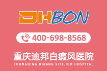 速览！重庆专业的白癜风医院-白癜风需要做哪些检查