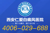 全新发现：西安好的白癜风医院“具体排名”-生活中哪些现象容易引发白癜风？