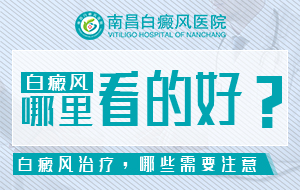 南昌白癜风专科医院是哪家-南昌治疗白癜风医院排名前三