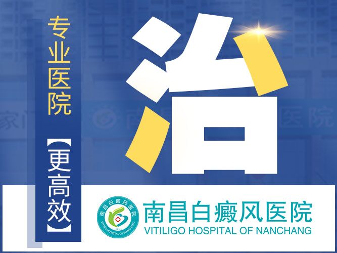 南昌能*白癜风吗-热搜排行“前三”！南昌治疗白癜风专科医院总榜正式揭晓