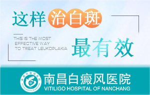 南昌治疗白癜风医院哪家好-白癜风更新:南昌治疗白癜风医院“前三强”排名总榜单发布